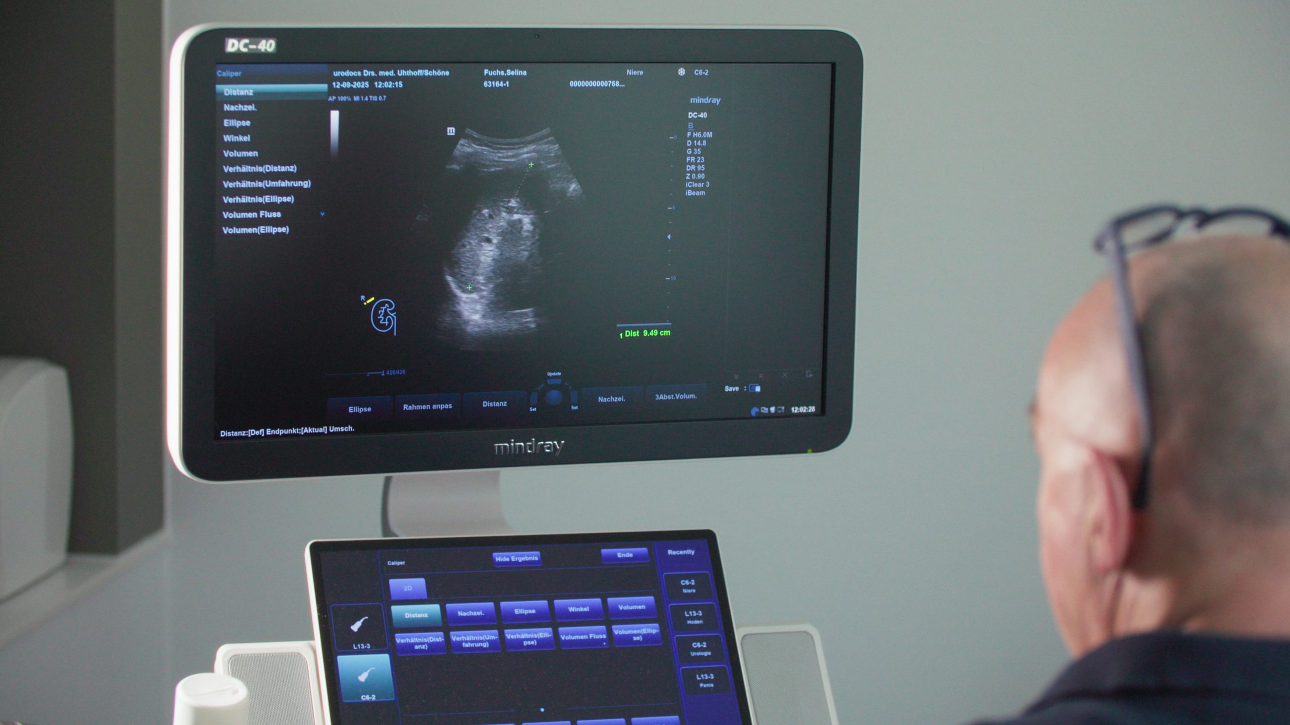 leistungsspektrum URODOCS 96 Scaled